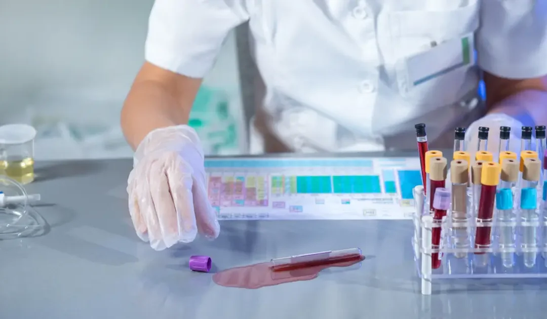 How to Handle Chemical Spills Safely – Laboratory Safety Guide