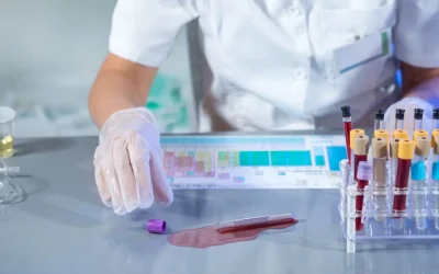 How to Handle Chemical Spills Safely – Laboratory Safety Guide